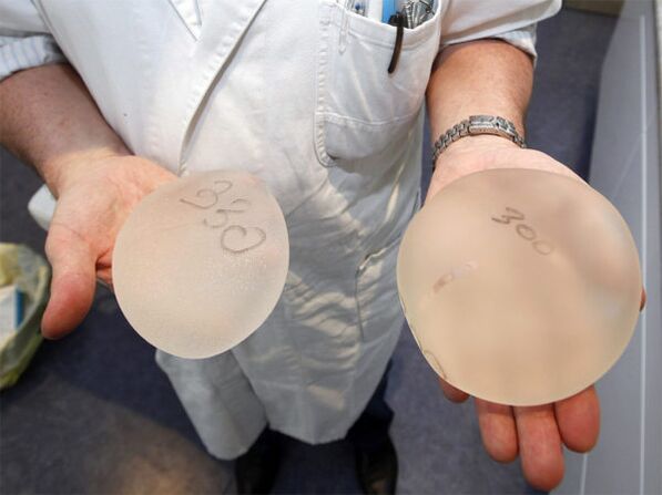 breast implants para sa pagpapalaki ng dibdib